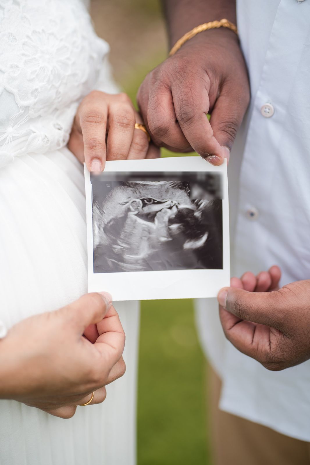 Couple holding their baby's scan photo